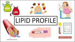 Lipid profileClear explanation.#Lipidprofile#MLT#Medilabacademy#Cholesterol#Triglycerides