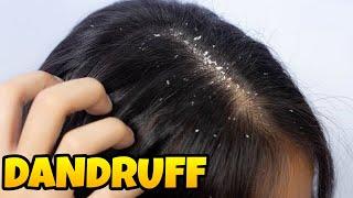 Dandruff Solution  خشکی اور سکری کا خاتمہ