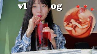 VLOG 드뎌 입체+정밀초음파 결과는?🫢 튼살크림 시작 임산부 꿀팁 복숭아 중독 임신 12주 일상