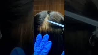 ASMR scalp Check and Medical Scalp 