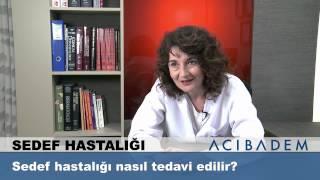 Sedef hastalığı nasıl tedavi edilir ?