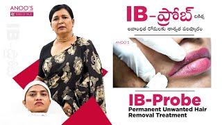 Permanent Solution for Unwanted Hair only @ Anoos  Advanced Ibprobe Technology #unwantedhair