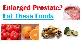 Best Foods to Eat with Enlarged Prostate  Reduce Risk of Symptoms Enlargement & Cancer