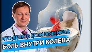 КРЕСТООБРАЗНЫЕ СВЯЗКИ  Как распознать и лечить повреждения