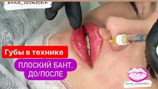 Губы в технике плоский бантдопосле #губы #губымосква