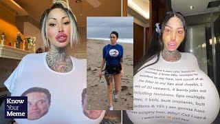 Plastic Surgery Addict Claims to Have the Worlds Fattest... Female Body Part