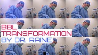 Patient BBL Experience With Dr. Raine  Mia Aesthetics