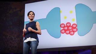 What You Can Do to Prevent Alzheimers  Lisa Genova  TED