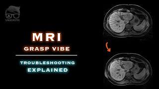 MRI – GRASP VIBE - TROUBLESHOOTING