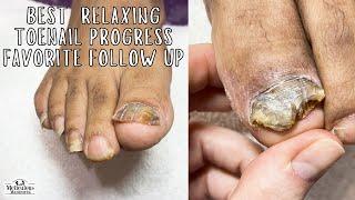 Best Toe nail Improvement and Relaxing Pedicure