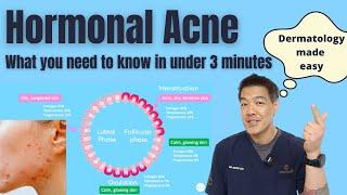 Hormonal acne explained in under 3 minutes  Dermatologist reviews