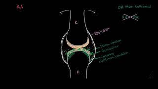 Osteoartrit ve Romatoid Artrit Patofizyolojisi Fen Bilimleri Sağlık ve Tıp