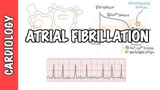 Atrial Fibrillation Overview - ECG types pathophysiology treatment complications