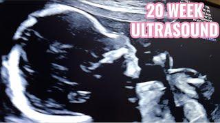 20 WEEK ULTRASOUND - HALF WAY PREGNANT