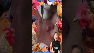 Blackheads Removal  Acne Treatment and Very Satisfying Satisfying Pimple pop #blackheads