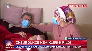 Öksürdükçe Kemikleri Kırıldı