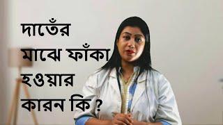 দাঁতের ফাঁকা হওয়ার কারন । Reason for Dental gap Diastema