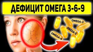 Все Симптомы Нехватки Омега-3. Отличия Омега 3-6-9. Продукты богатые жирными кислотами