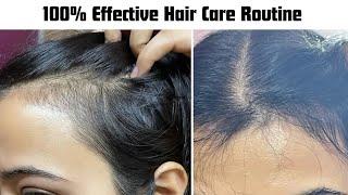 How To Grow Hair Naturally with Protouch Hair Growth Oil & Hair Drops  @beautyguider2395