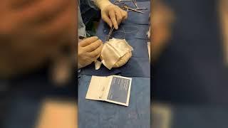 Direct To Implant Prepectoral Breast Reconstruction Using AlloMend Dermal Matrix