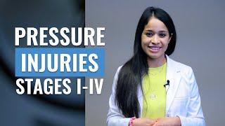 How to identify a Pressure Ulcer? Stages I - IV  Wound care for Nurses  Christina NP  Caring Casa