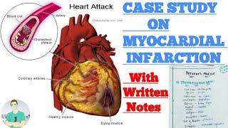 Case Study On MI  Case Study कैसे लिखते है?  Case Presentation On MI  Jeet On Tube By-Jeet Meena