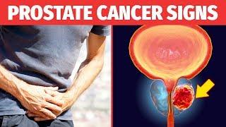 Prostate Cancer Warning Signs Common Causes of Prostate Cancer