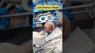 Live Femur Bone Head