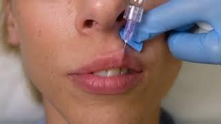 Плоский бант 100 %      #обучениекосметологов #губы #filler #fillerlips #ботокс #тп #плоскийбант