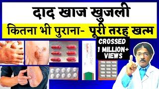 Dad Khaj Khujli Ki Dawa  दाद खाज खुजली को जड़ से ख़तम कैसे करे?  3 Best Medicine For Dad Khaj Khujli