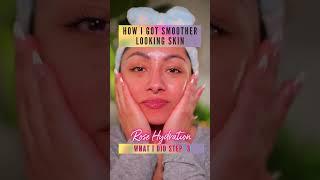 STEP 3 - How to get rid of acne fast  Mirenesse Australia #skincareroutine #acne #acnetreatment
