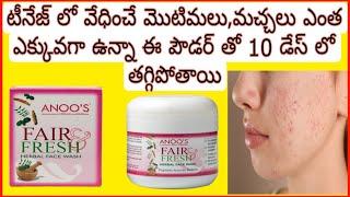 Anoos fair&fresh herbal face wash for pimple free bright  skin