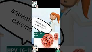 Colposcopy and HPV 1618 #gynaecologist #cancer #ytshorts