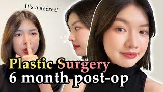 SIX MONTHS REVIEW...  Braun Plastic Surgery