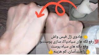 #asena_azam2021راز⁉️ژل شستشوی صورتطبیعی، یک دقیقه‌ای از تأثیر بینظیر اون متحیر بشید#رفع_تیرگی_پوست