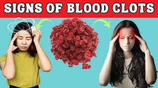8 WARNING Signs of Blood Clots That Could Save Your Life