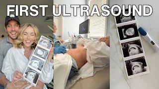 Our First Doctors Appointment & Ultrasound  Pregnancy Vlog