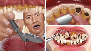 The Rock helps remove tartar and treat tooth decay  ASMR