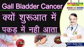 GALL BLADDER CANCER  क्यों शुरुआत में पकड़ में नहीं आती  GALL BLADDER CANCER  PART 1