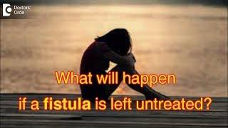 What will happen if a fistula is left untreated? - Dr. Rajasekhar M R