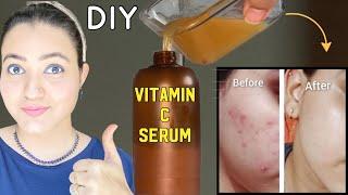 घर पर बनाये ये *Vitamin C Serum*  काले धब्बे  Acne Marks Pigmentation को कम करें और पाएं Bright Skin