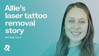 Allies Laser Tattoo Removal Journey