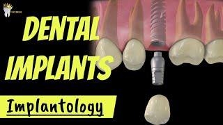 DENTAL IMPLANTS  INTRO and ADVANTAGES OSSEOINTEGRATION EXPLAINED