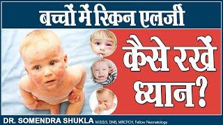 बच्चों में स्किन एलर्जी कैसे रखें ध्यान ?  Skin Allergy in Children  Dr. Somendra Shukla