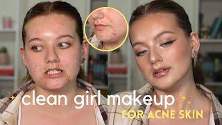 *in depth* CLEAN GIRL makeup tutorial for acnetexturedscarred skin