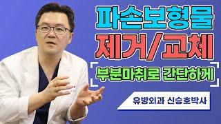 파손보형물 교체 부분마취로 간단히 SHINYU CLINIC 신유외과