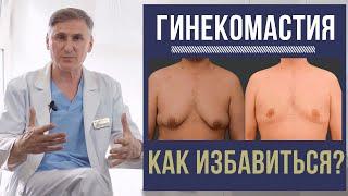 ГИНЕКОМАСТИЯ КАК ИЗБАВИТЬСЯ?  ОСЛОЖНЕНИЯ