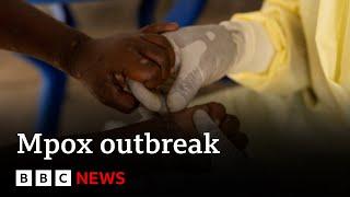 Mpox declared public health emergency in Africa  BBC News