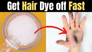 Remove Hair Dye off your Skin Nai Hands When Dried with Baking Soda - hand ko kaise saaf karen