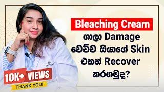 Bleaching Cream ගාලා Damage වෙච්ච ඔයාගේ Skin එකත් Recover කරගමුද?  Cosmetics.lk